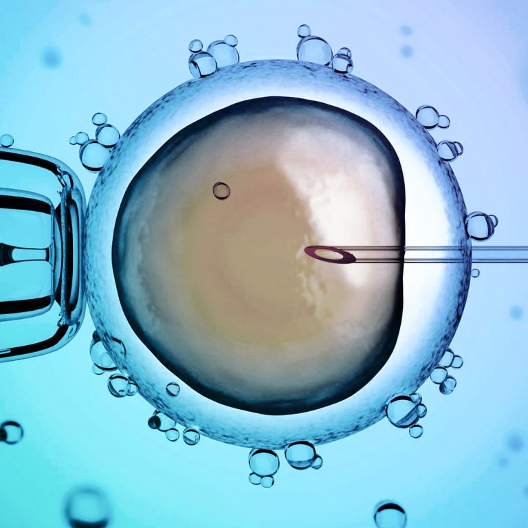Inseminação Artificial por Fertilização In Vitro – Clínica Genesis